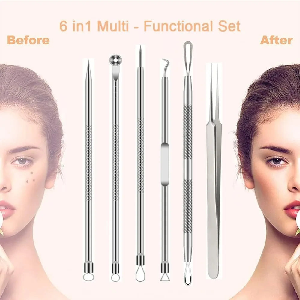 6Pcs Stainless Steel Blackhead Remover Kit Comedone Extractor Tweezers Precision Tools for Acne Blemish Removal Facial Skin Care
