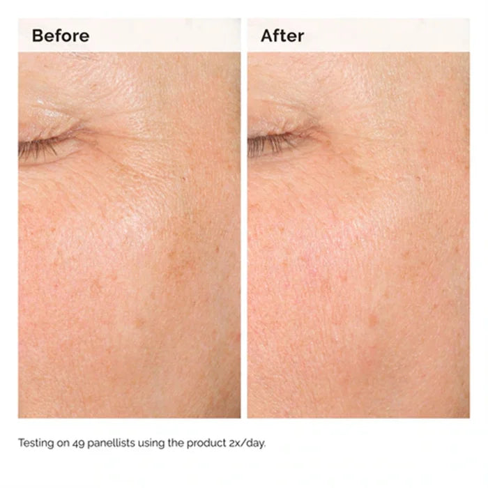 Alpha Arbutin 2% + HA 30ml Serum Minimise The Appearance of Dark Spots and Discolouration Hydrate The Skin