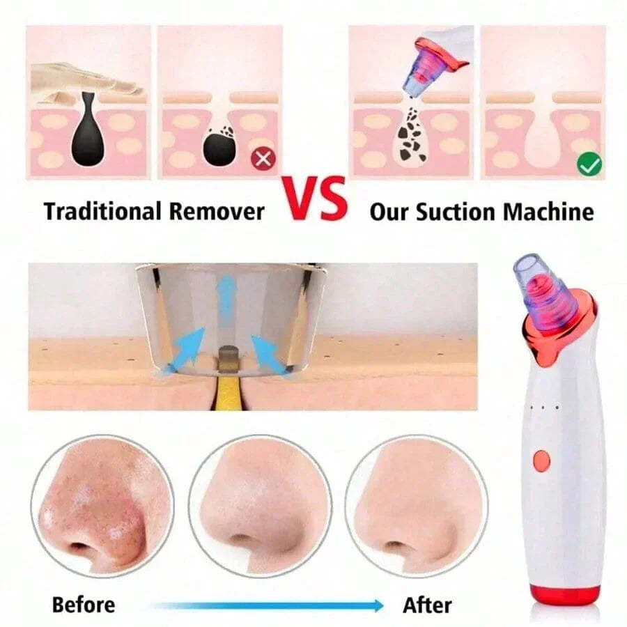 Electric Blackhead Remover Vacuum Cleaner
