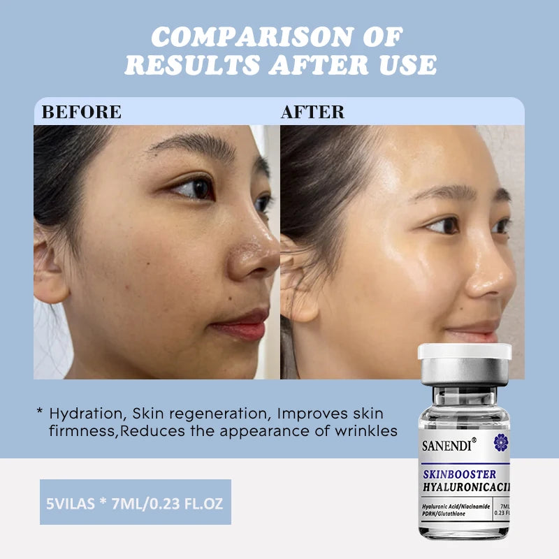 7ML PDRN Hyaluronic Acid Skin Care Gel with Niacinamide for Derma Pen Moisturizing Water Locking Hydrating Skin Treatment