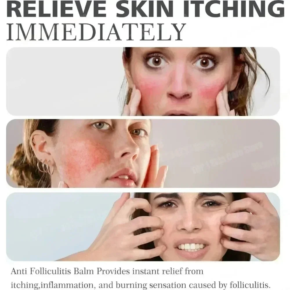 7day Acne Removal Comfortable Acne-removing Liquid Improve Acne Convenient Facial Repair Solution Skin Care Products Gentle