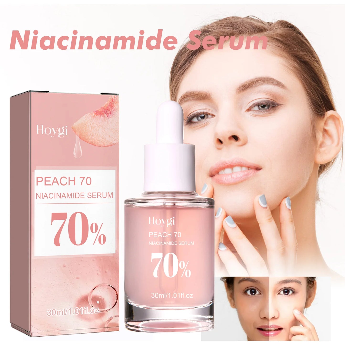 Peach 70% Niacinamide Facial Serum Fade Melanin Moisturzing Shrink Pores Smooth Brightening Skin Care Dark Spot Remover Serum