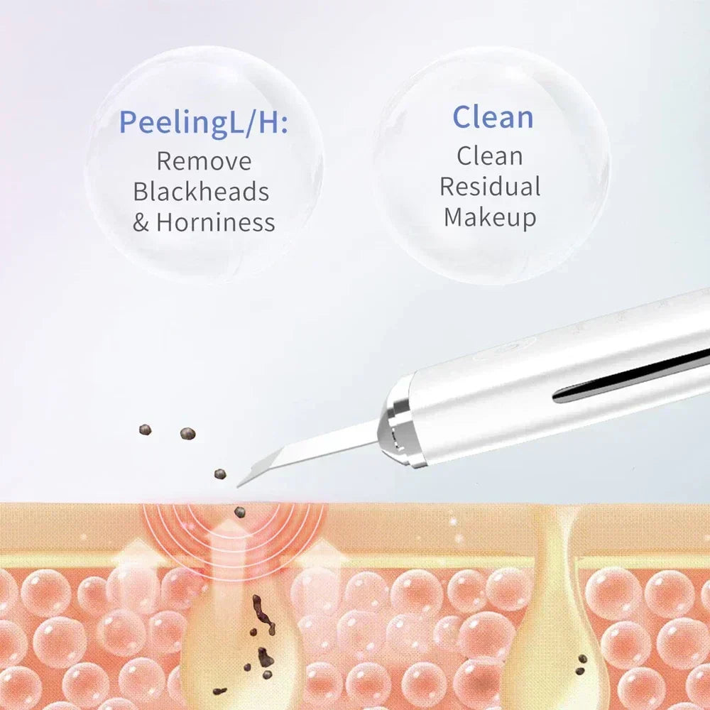 Electric Facial Skin Scrubber Spatula
