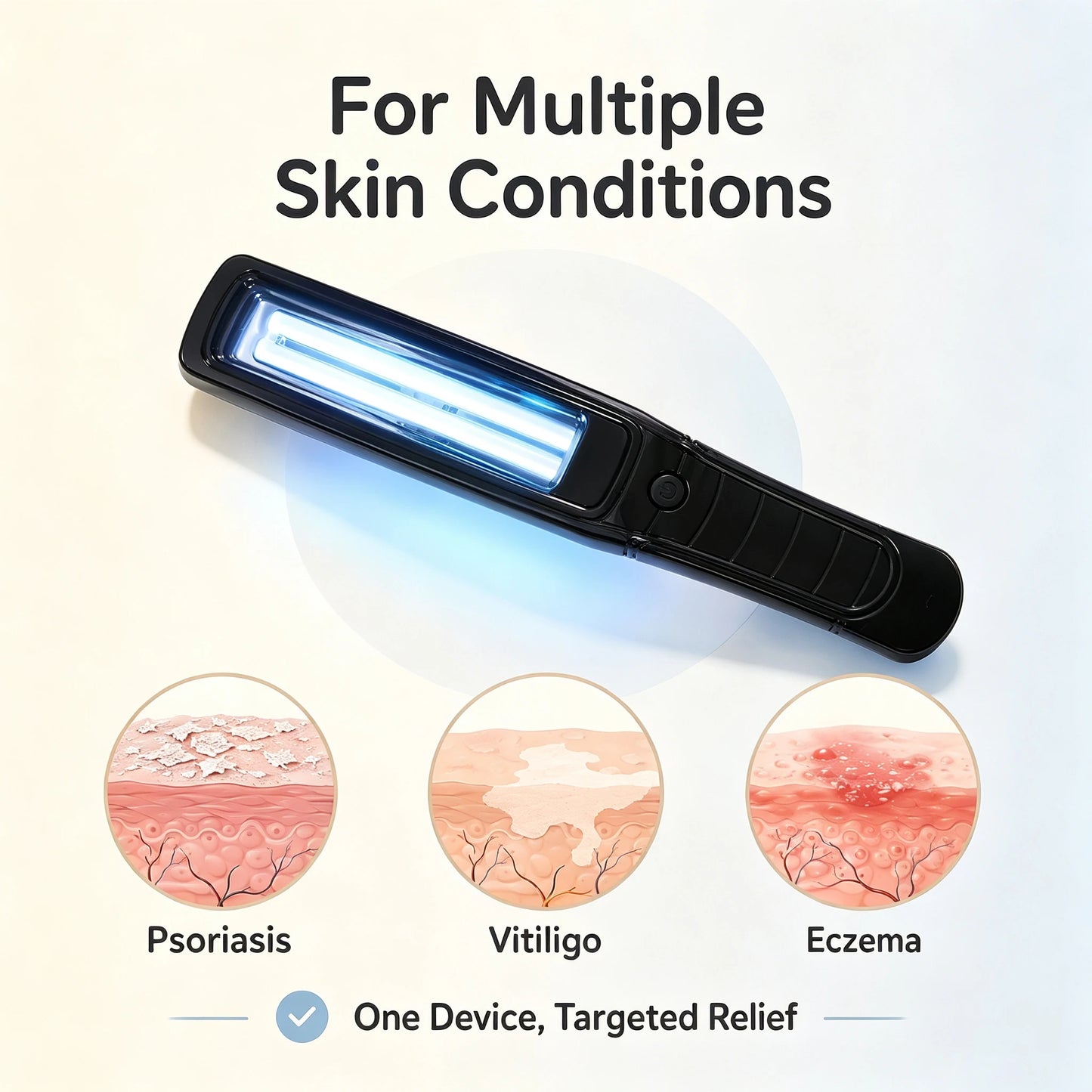 Handheld 311nm Narrowband UVB Phototherapy Lamp Portable UV Light Wand For Home Local Skin Care