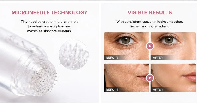 0.25mm Microneedle Essence Kit, Transparent Texture Facial Serum Set Anti‑Aging Skin Regeneration Home Beauty Skin Care