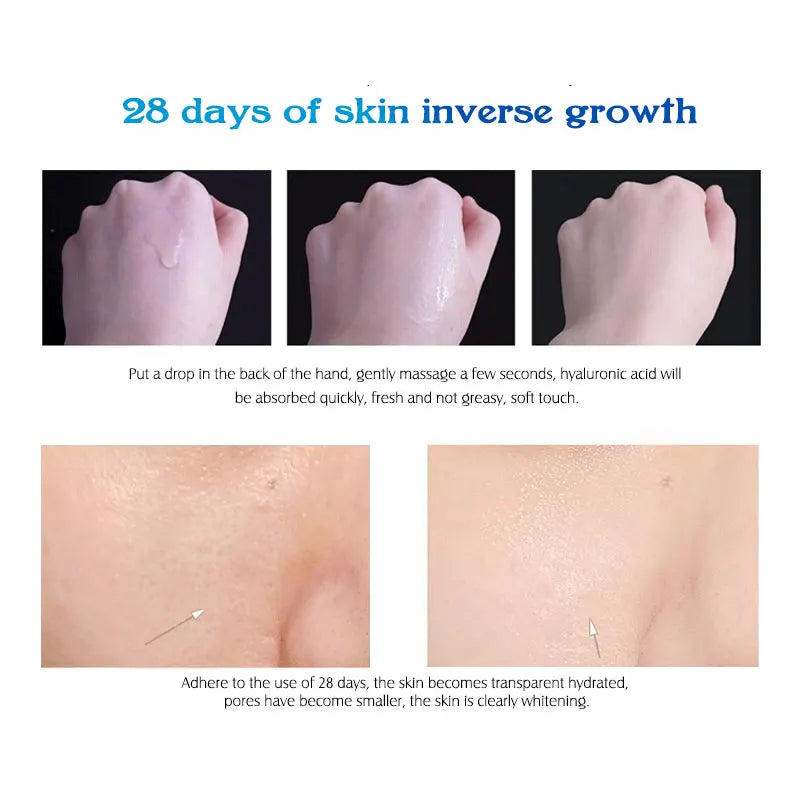 ARTISCARE Hyaluron Acid Serum 10pcs/Lot for Face Moisturizing and Hydrating Anti Aging Skin Care Essence Facial Care