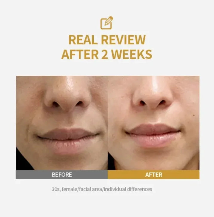 Kojic Acid Niacinamide Facial Serum Hydrating Nourishing Revitalizing Soft Smoothing Improves Dull Complexion Skin Care