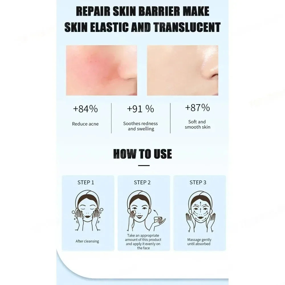 Face Serum Fruit Acid Acne Treatment Oil Control Remove Blackheads Shrink Pores Skin Texture Improve Care
