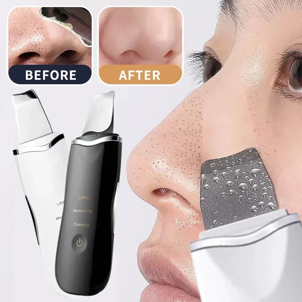 Electric Facial Pore Cleansing Spatula