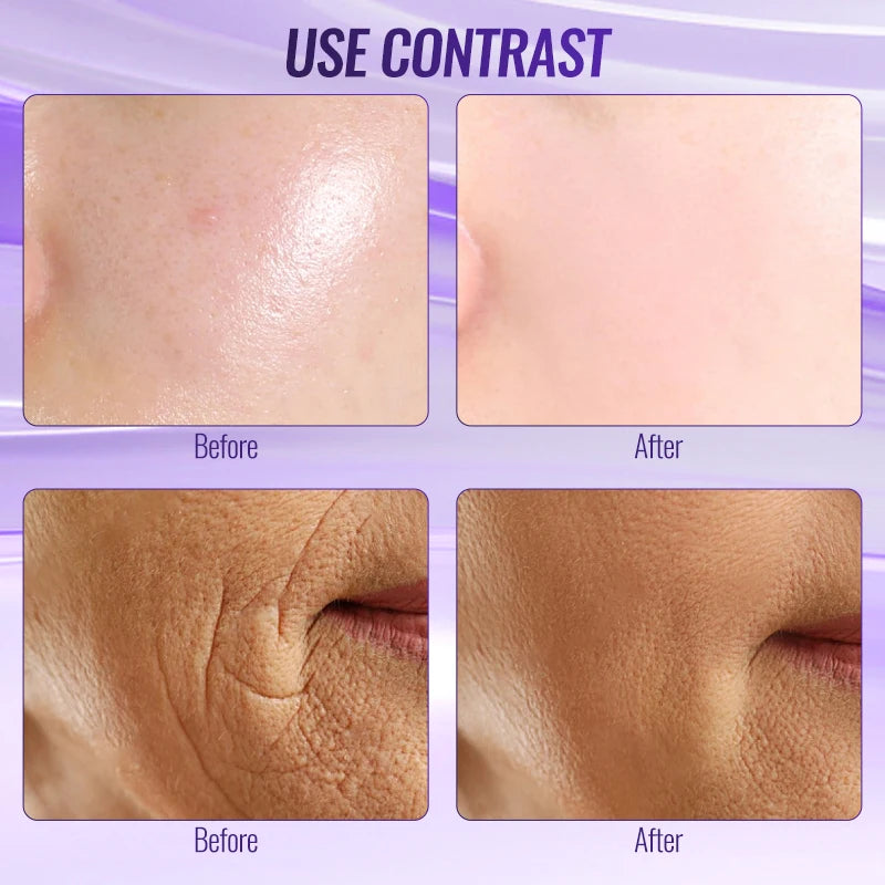 High Frequency Appliance Electrode Tube Wand Electrotherapy Skin Care Facial Spa Tightening Acne Spot Wrinkles Remover