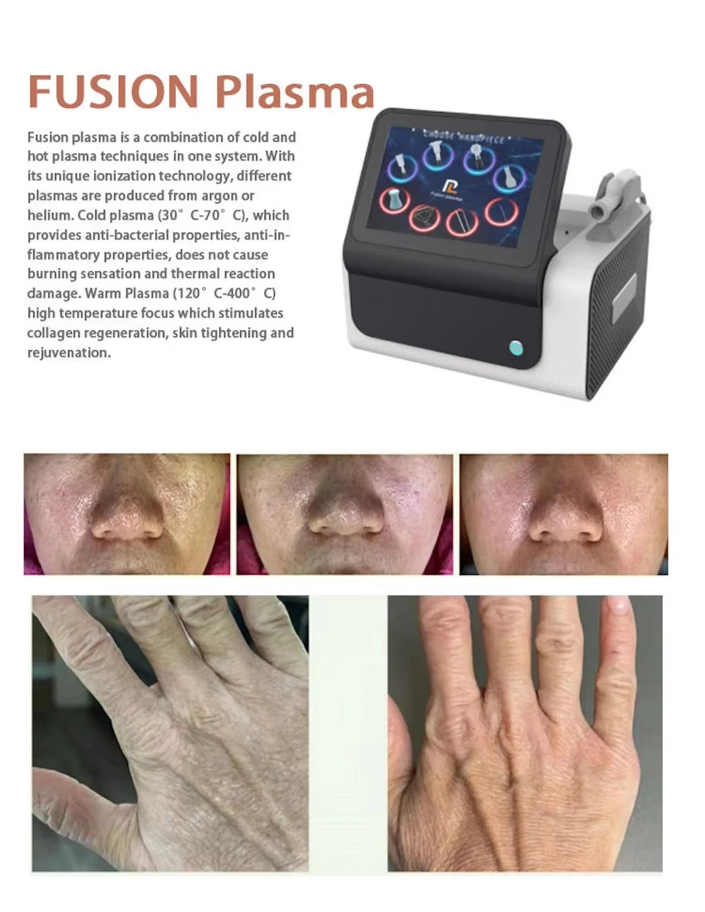 Cool Ion Beauty Device Professional Skin Revitalizing Wrinkle Smoothing Blemish Care Face Toning Youthful Radiance Salon System