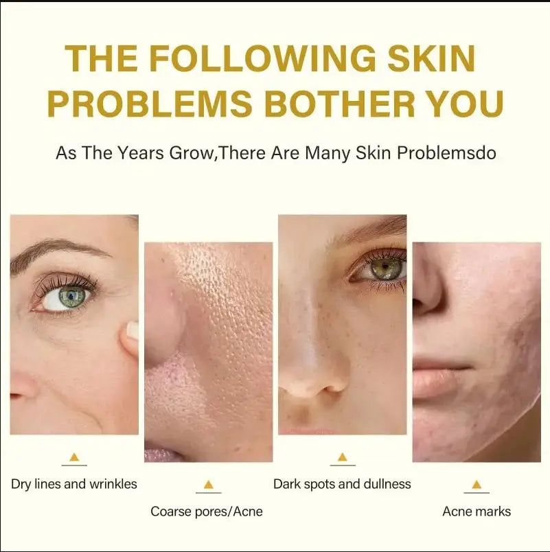 Dilute melanin, acne, 50% TCA, high-quality chemical exfoliation, acidic skin beauty care