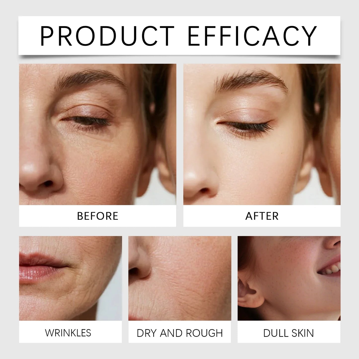 Radiant Flawless Skin Micro Infusion Serum Kit - At Home Facial System Beauty Tool Skin Care for Face | 0.25MM Needle