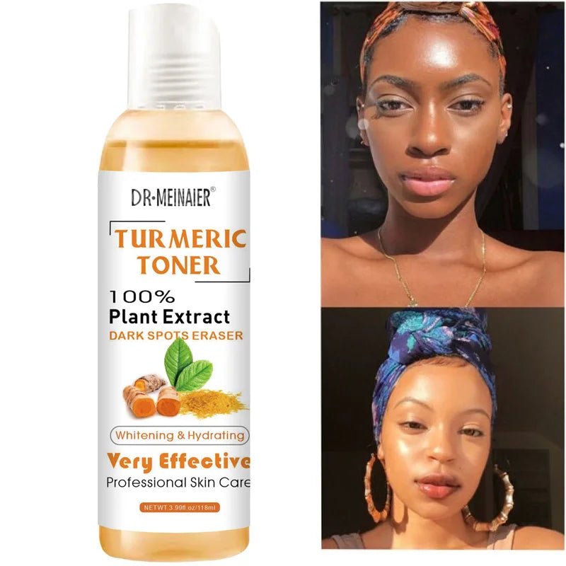 118ml Tumeric Dark Spots Toner Spots Eraser Corrector Turmeric Fade Blemishes Dark Spot Remover Acne Remover Toner for Dark Skin