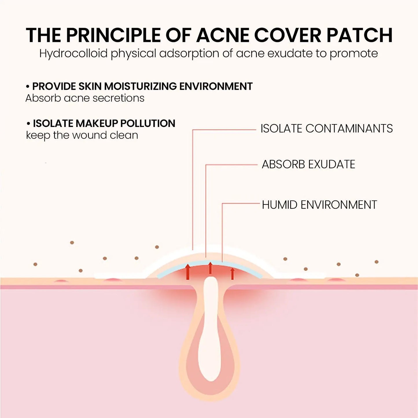 240 pieces of multi-color star acne patches, facial acne patches, concealer acne patches, and pimples patches, ultra-thin