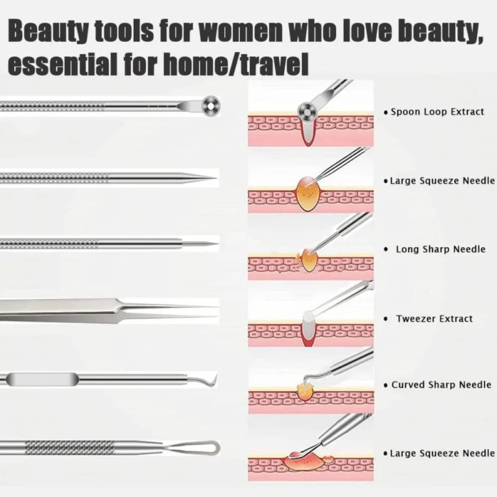 6Pcs Stainless Steel Blackhead Remover Kit Comedone Extractor Tweezers Precision Tools for Acne Blemish Removal Facial Skin Care
