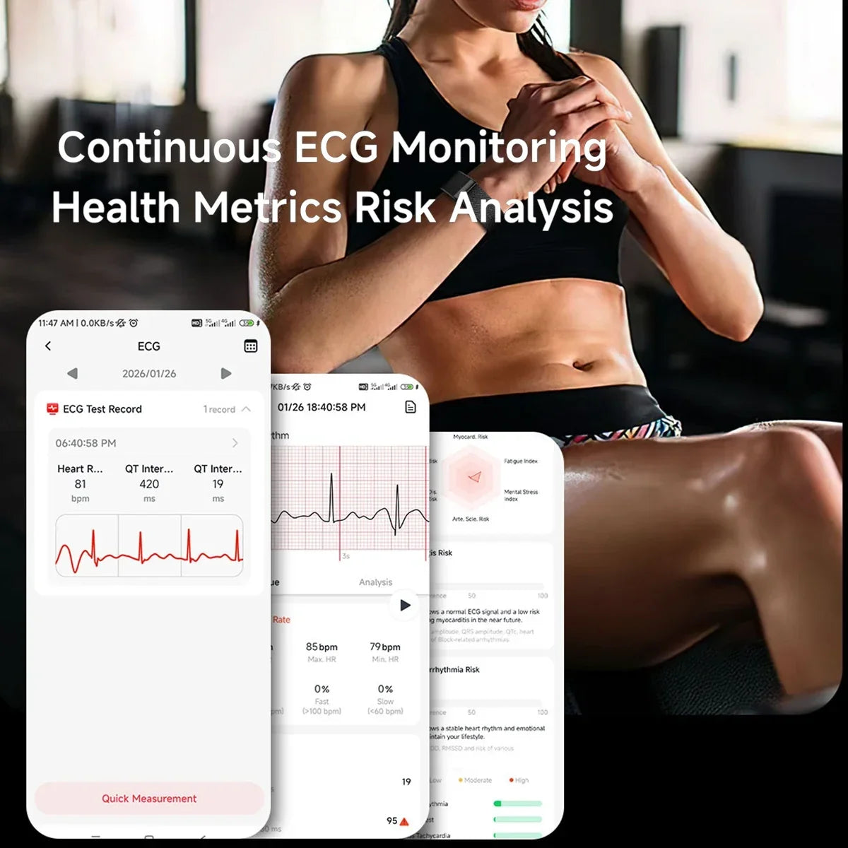 2026 New Nursing Grade Smart Bracelet VWAR Loop Life SpO2 Blood Lipid Uric Acid ECG+PPG Waterproof Band Sport Fitness Tracker