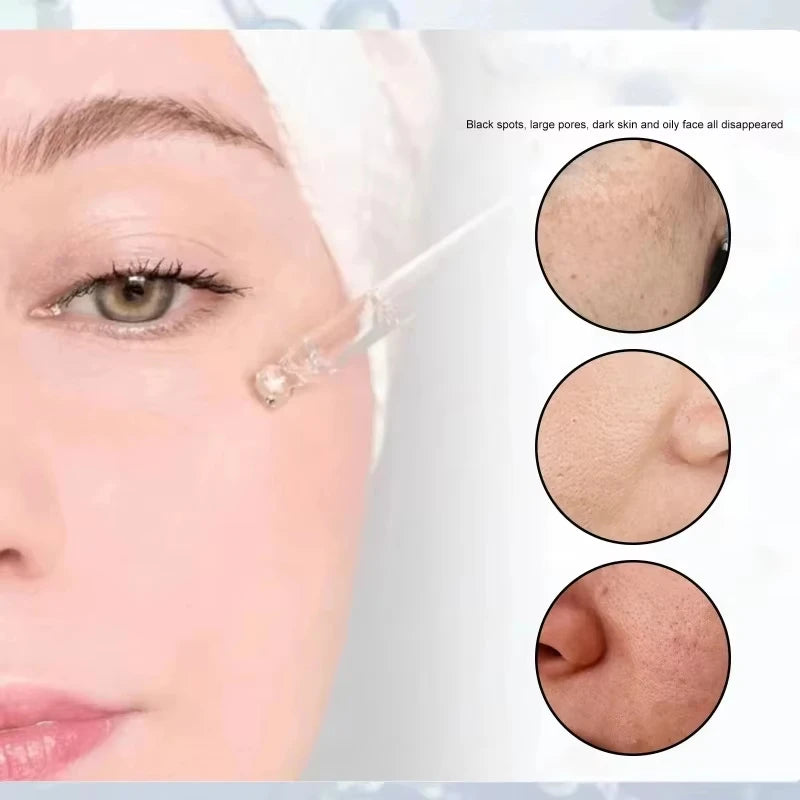 Peptide Collagen Serum Remove Acne Essence Enhances Skin Radiance Provides Deep Hydration Smooths Skin Texture Korean Products