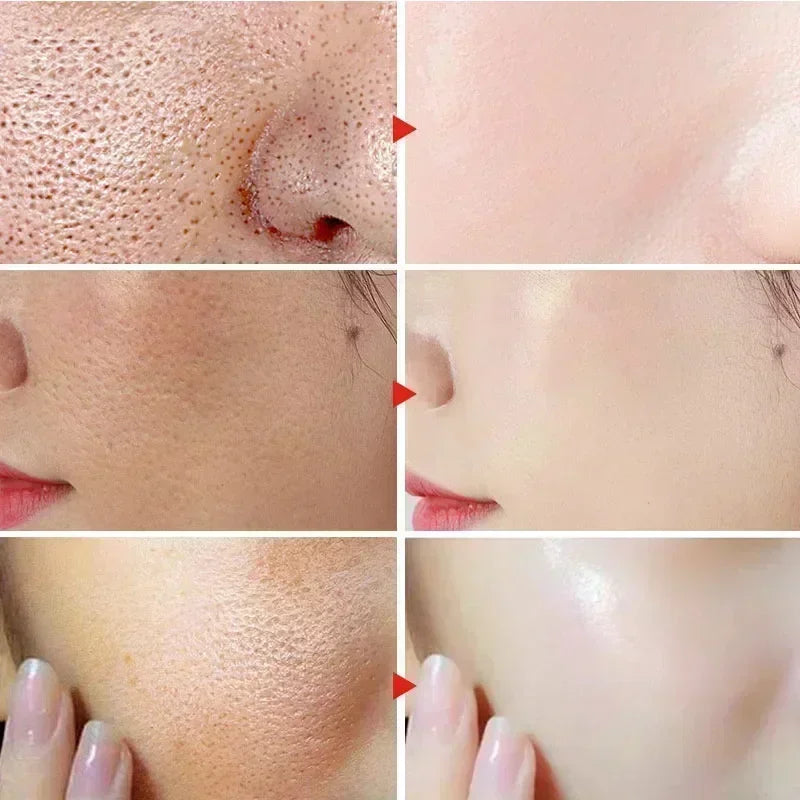 2495  Shrink Pores Serum Salicylic Fruit Acid Face Remove Blackheads Oil Control Gel Whitening Moisturizing Smooth Skin Care Pro