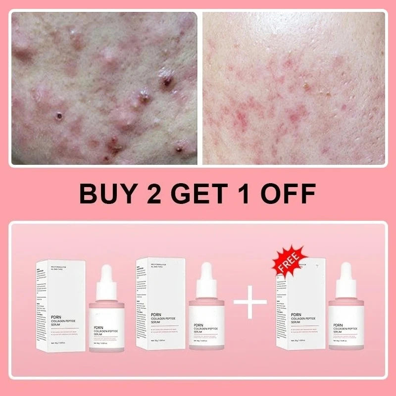 Salmon PDRN Collagen Peptide Facial Serum for Dull Skin - Boosts Elasticity Skin Renewal Repair Korean Beauty Product