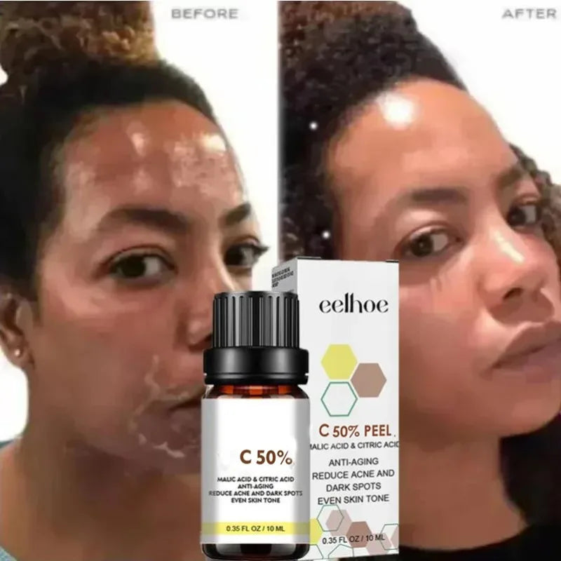 Face Care Exfoliating Serum Radiant Skin Fade Dark Spots Pigmentation for Even Brighter Skin Remove Spots Arm Knee Legs Melanin