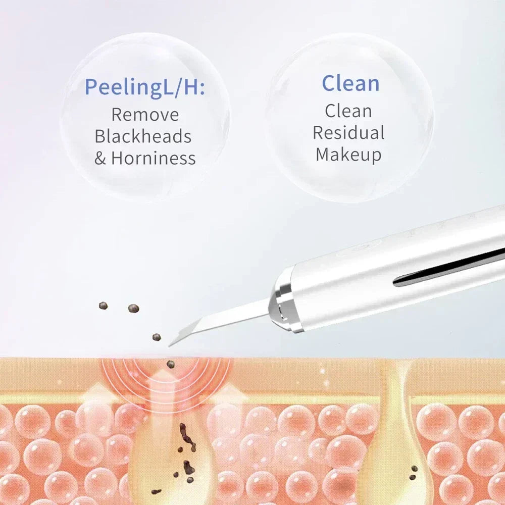 Electric Facial Pore Cleansing Spatula