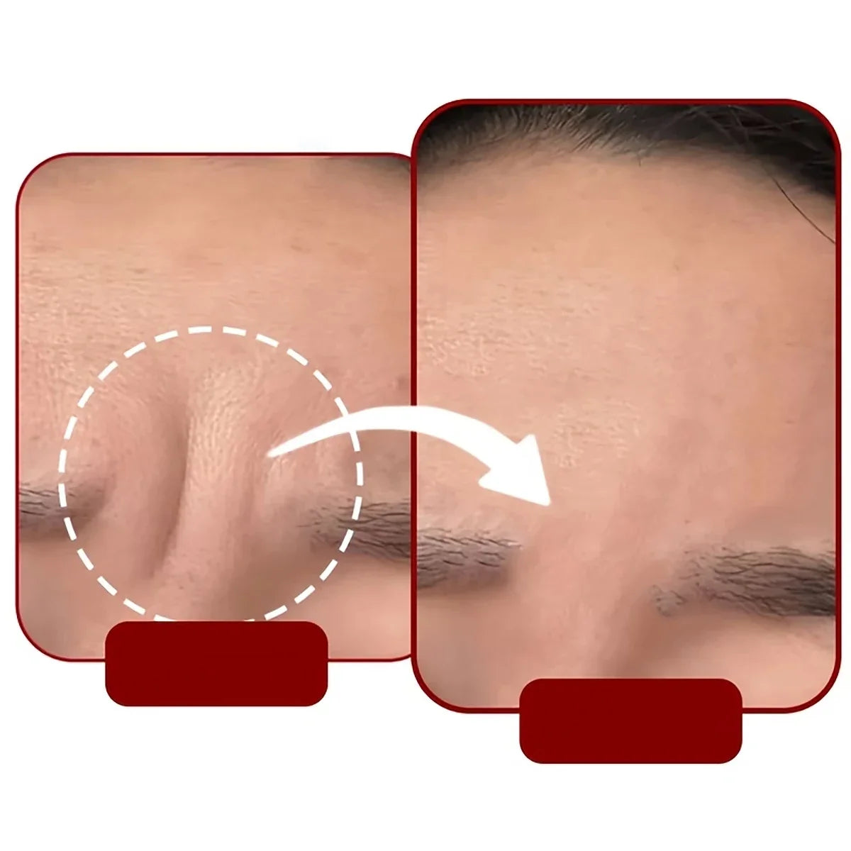 54/30/6 Pieces of Self-Adhesive Sleep Forehead Patches - Reusable Anti-Wrinkle Elastic Patches for the Face, Suitable for Full Face Facial Training, Washable, Sticky and Reusable