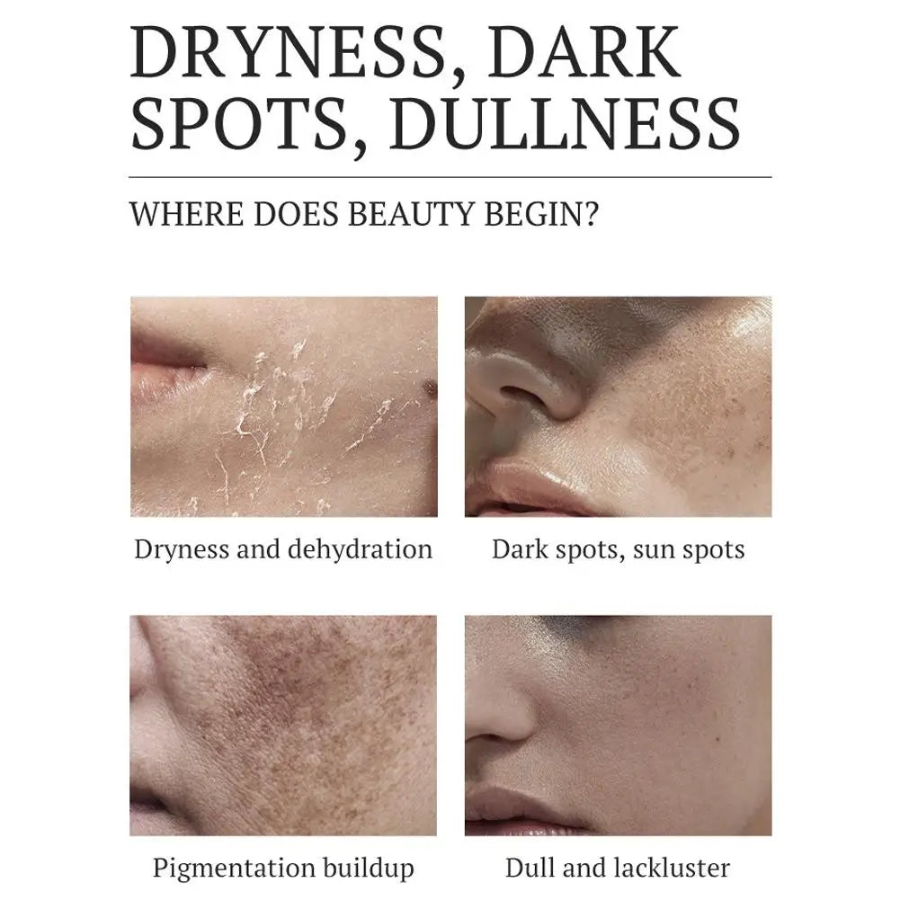 1/2/3PCS Dark Spots Removal Cream Facial Whitening Freckle Acne Mark Pigmentation Removal Melanin Skin Correction Care