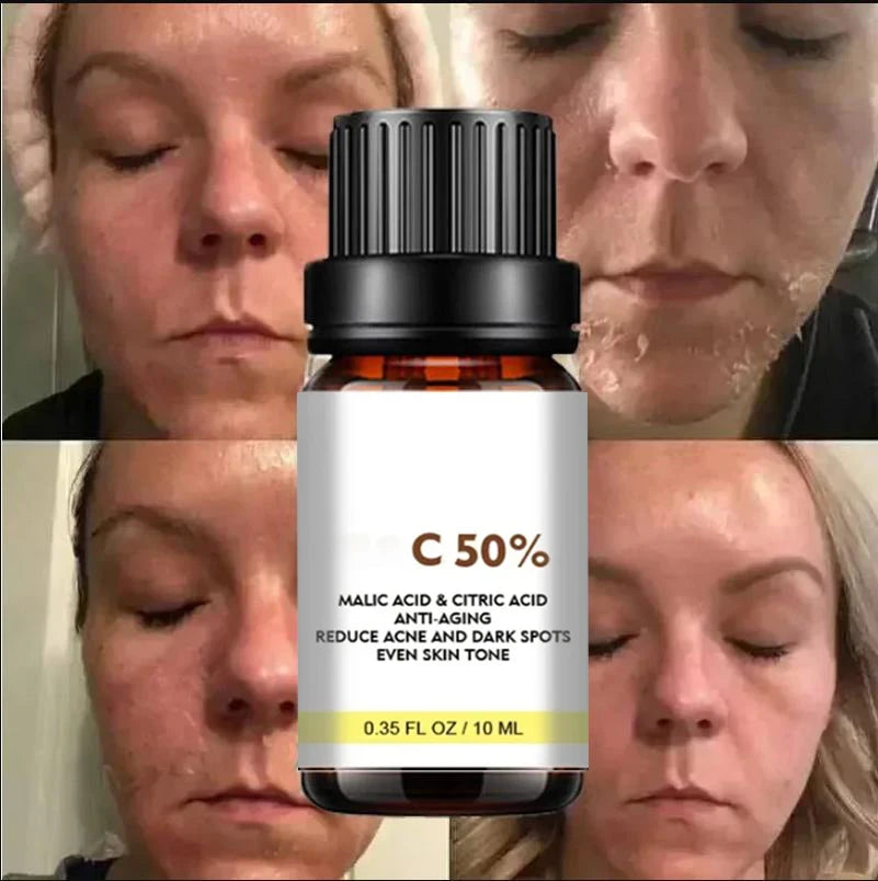 Face Care Exfoliating Serum Radiant Skin Fade Dark Spots Pigmentation for Even Brighter Skin Remove Spots Arm Knee Legs Melanin