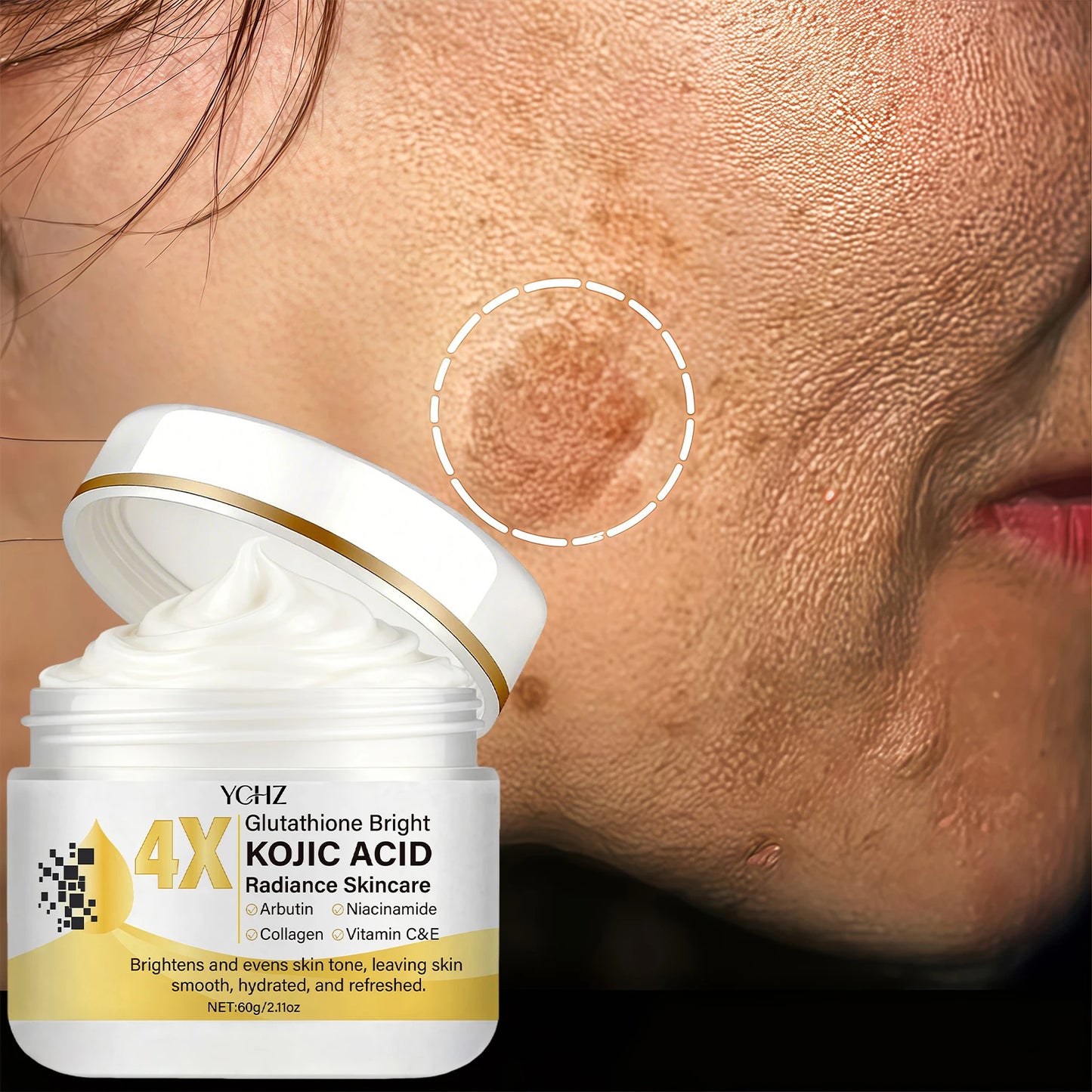 Kojic Acid Cream, Evens Out Skin Tone, Eliminates Dark Spots and Dullness - Non-Greasy, Suitable for Both Men and Women - Whitening and Moisturizing Cream, for Day and Night Use - 60g