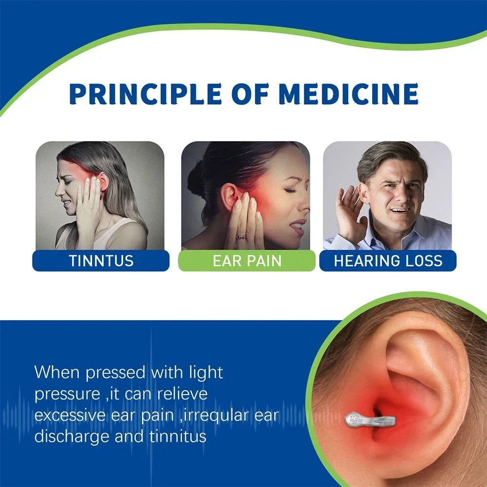 Anti Tinnitus Magnetic Clip Portable Relief Ringing pain Itching Clean Ear Canal Blockage Improve Hearing Loss Calm Ear Pressure