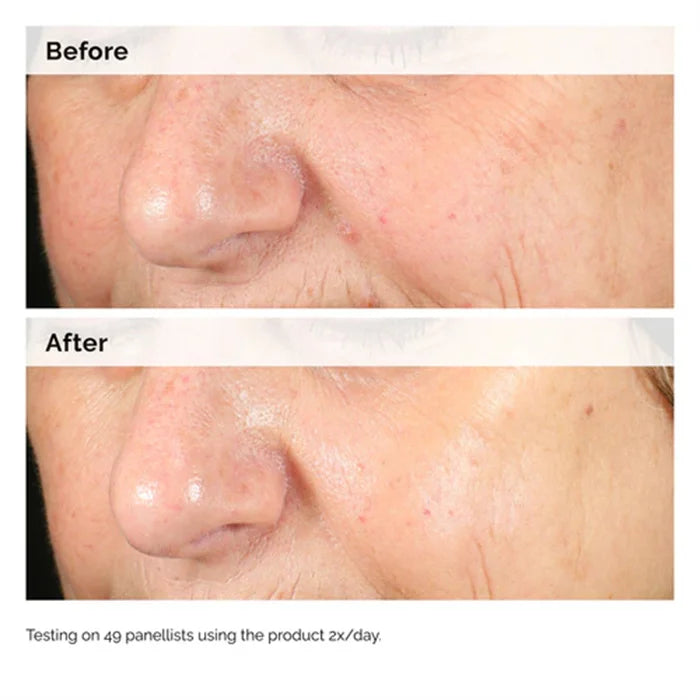 Alpha Arbutin 2% + HA 30ml Serum Minimise The Appearance of Dark Spots and Discolouration Hydrate The Skin